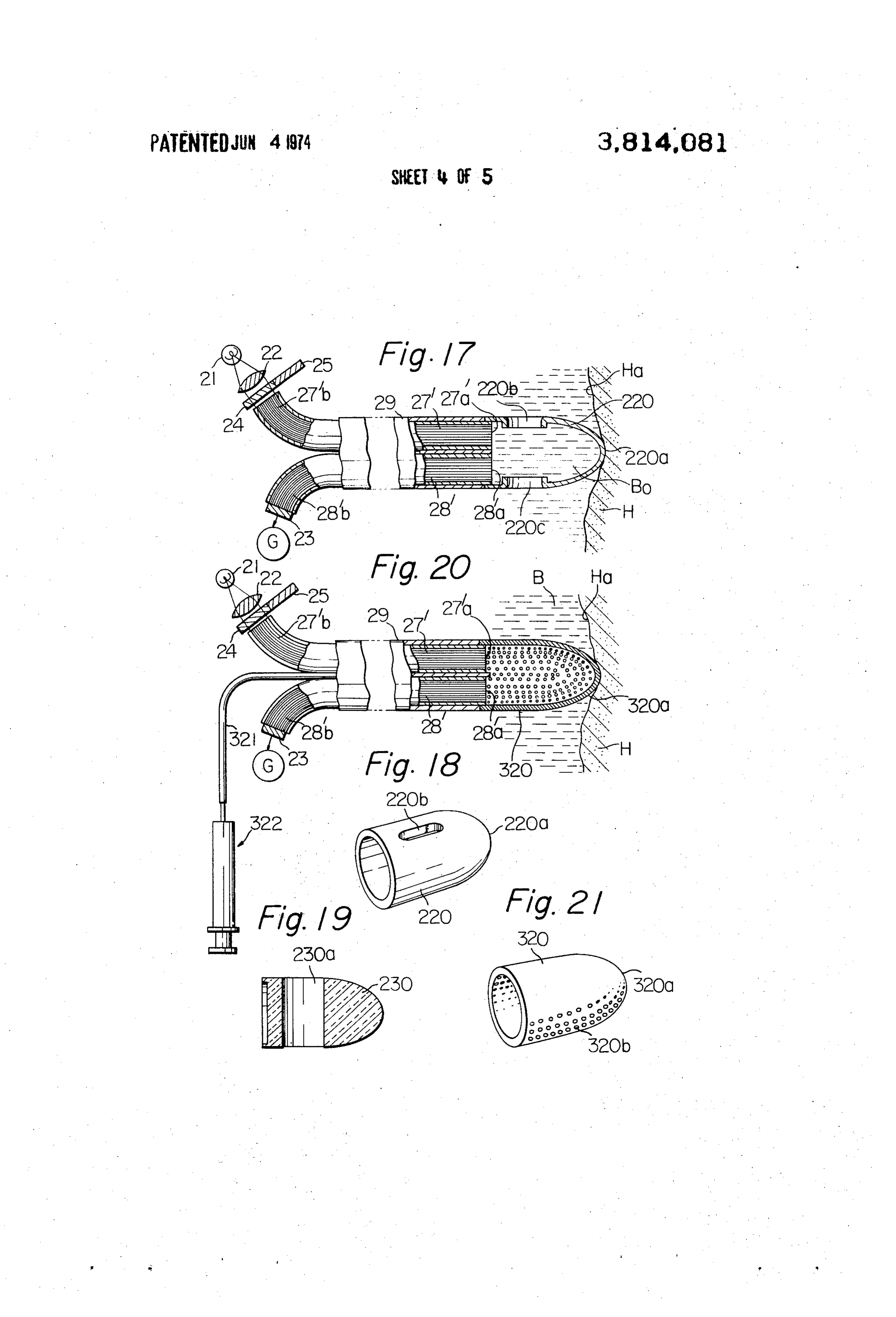 Page 5 of the original patent document