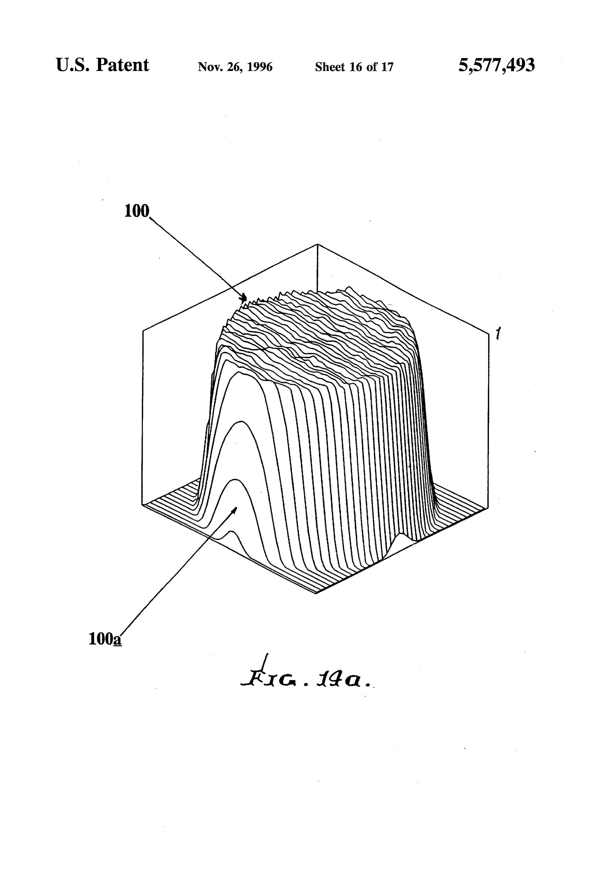 Page 17 of the original patent document